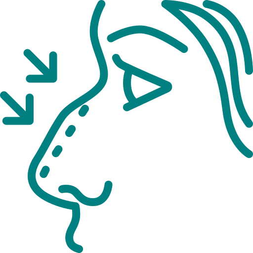 Rhinoplasty